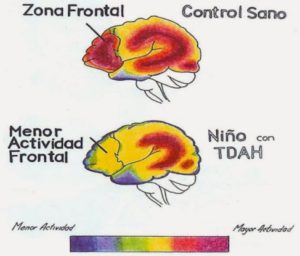 efectos del neurofeedback en el cerebro